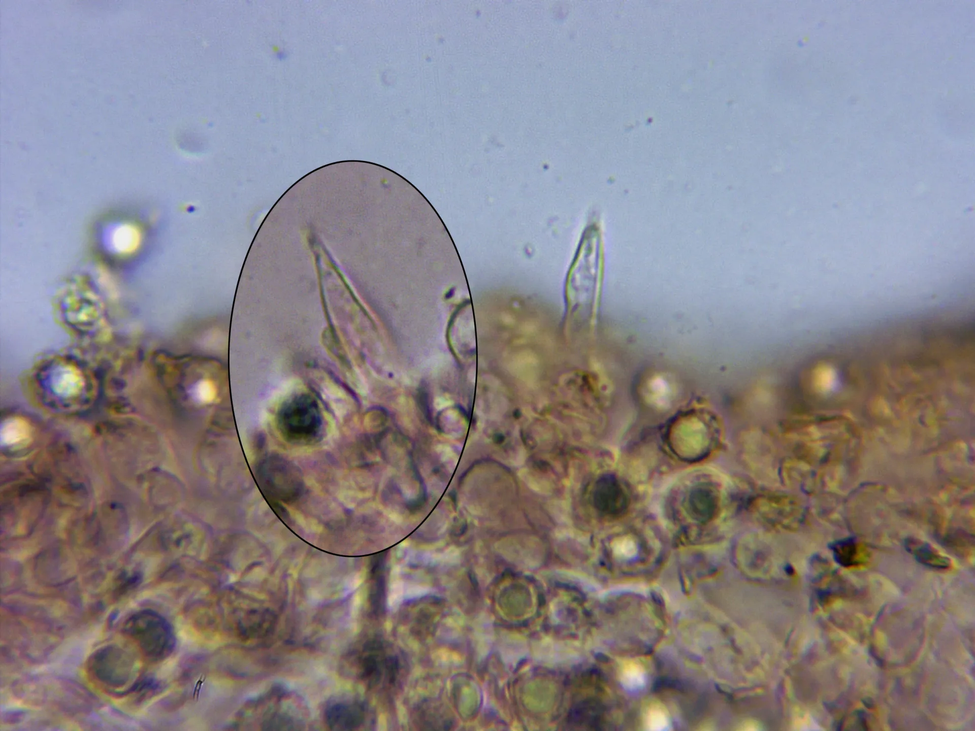 Microscopía de Lactarius subdulcis - 10 - Queilocistidios